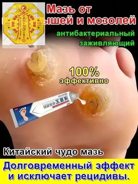 Mазь от мозолей стержневых и натоптышей ,Крем от сухих мозолей, шипицы, бородавок, натоптышей,20 г.