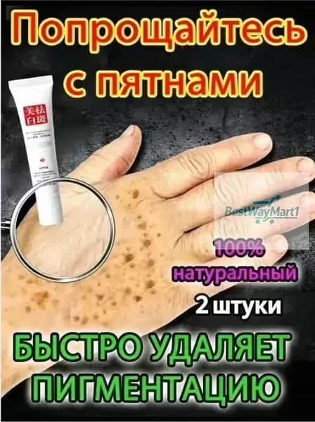 Отбеливающий крем от веснушек и солнечных пятен, подходит для удаления и исчезновения желтых пятен и старчес2 штуки