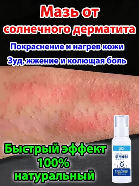 Крем для лечения солнечного дерматита,Восстановление кожи после солнечных ожогов крем после загара