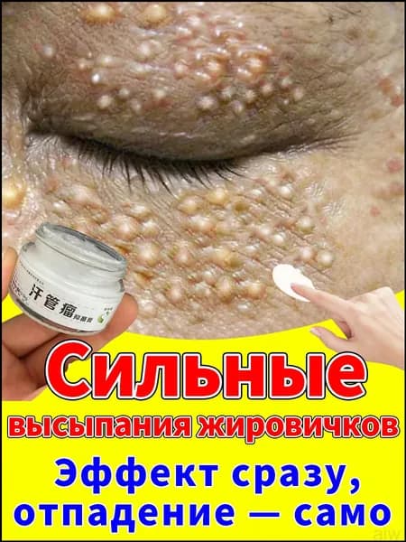Интенсивный корректирующий крем для кожи вокруг глаз для смягчения и выравнивания текстуры, 20 г