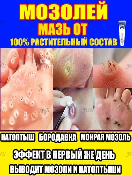 - Средство от натоптышей и бородавок смягчает мозоли, удаляет шипицы, натуральный состав