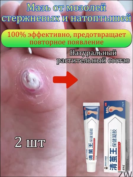 Пластырь от мозолей, бородавок и натоптышей лечебный, быстрое смягчение, безболезненное удаление,20 г.2шт