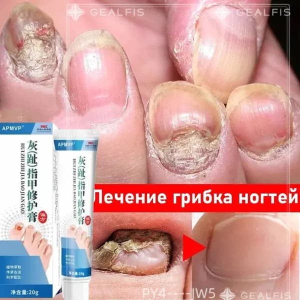 Средство для ногтей и кутикулы