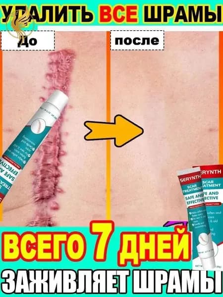 Качественный регенерирующий крем 20г для осветления следов акне, ожогов и выравнивания кожи от шрамов и рубцов.