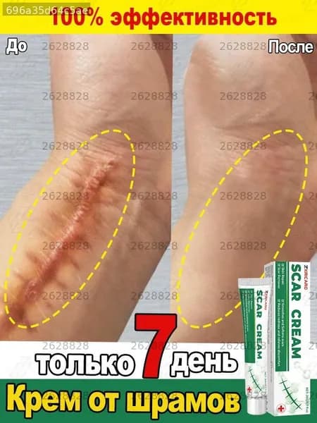 Крем от шрамов и рубцов, гель от прыщей на лице, мазь против ожогов и пигментных пятен и теле, средство от постакне30 г
