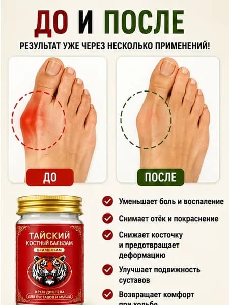 Легендарный тайский крем от косточки на ноге