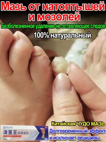 Mазь от мозолей стержневых и натоптышей ,шипицы, бородавок, натоптышей ,Безопасно и без повторений 20 г.