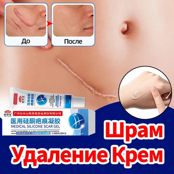 китайский Силиконовый Крем от шрамов и рубцов , от растяжек, от постакне, от ожогов, 15 г