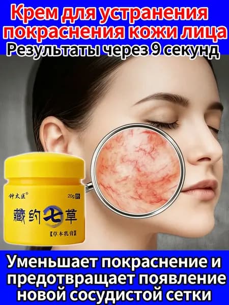 Крем для лица Иверлайт против розацеа, 20 гр