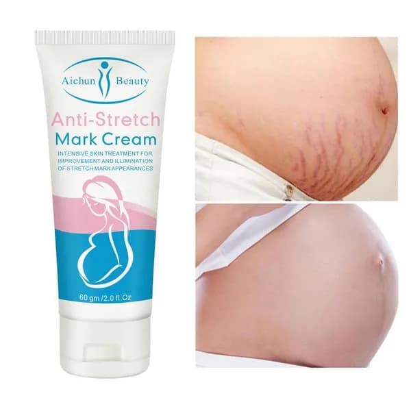 Anti-Stretch Mark Cream укрепляющий , крем укрепляющий от растяжек для беременных, 60 г
