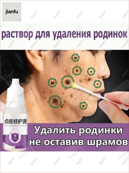 Крем для удаления родинок 10 мл от пятен черных родинок и бородавок Восстановите гладкость кожи