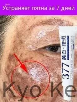 Крем против пигментации и веснушек, 30 г