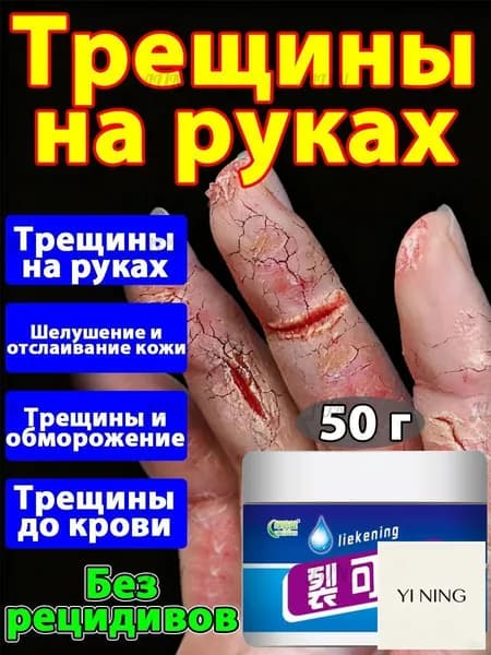 Китайская мазь от трещин на руках: натуральный состав и быстрое действие.
