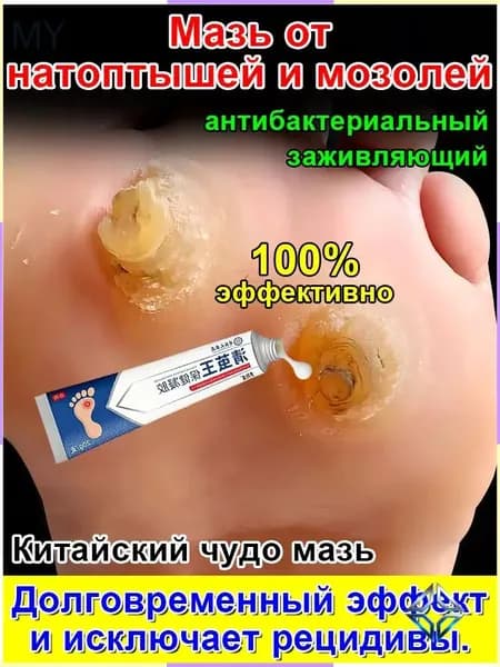 Mазь от мозолей стержневых и натоптышей ,Крем от сухих мозолей, шипицы, бородавок, натоптышей,20 г.