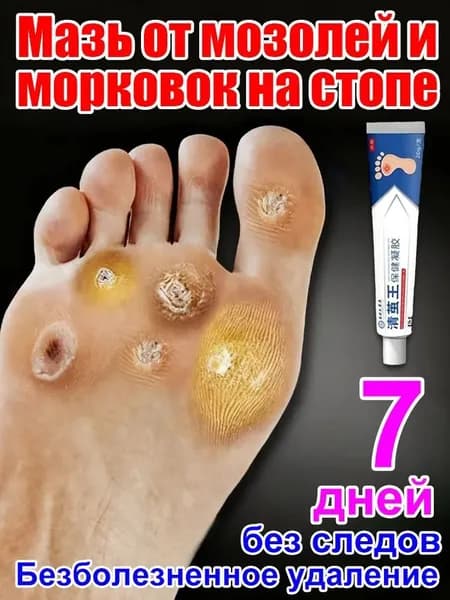 Мазь для лечения натоптышей и мозолей на ногах, которые быстро отваливаются, 20 г.