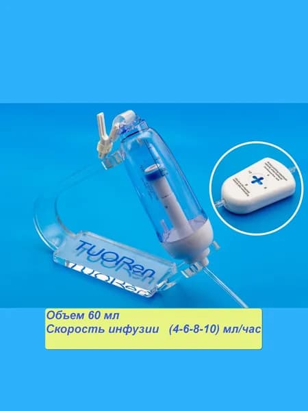 Одноразовая инфузионная помпа Tuoren, объем 60 мл, с регулятором скорости инфузии(4-6-8-10) мл/час