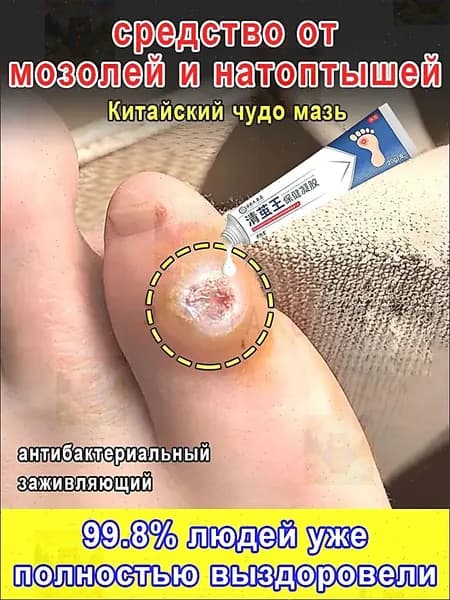 Пластырь от мозолей, стержневых натоптышей и бородавок 20 г Китайский чудо мазь