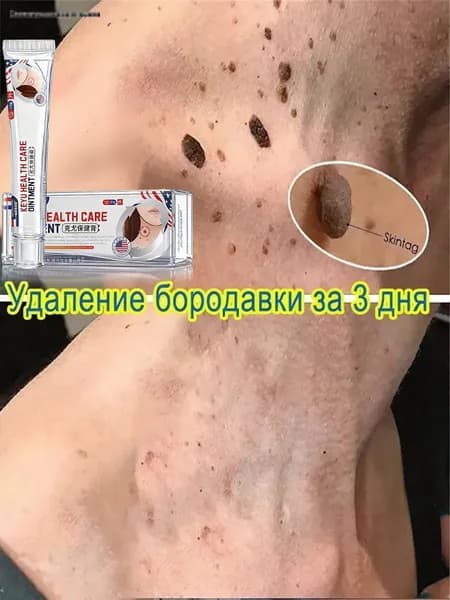 Verrutol / Чистотел от папиллом и бородавок, средство от папиллом, от бородавок, от мозолей, крем для тела, чистоте