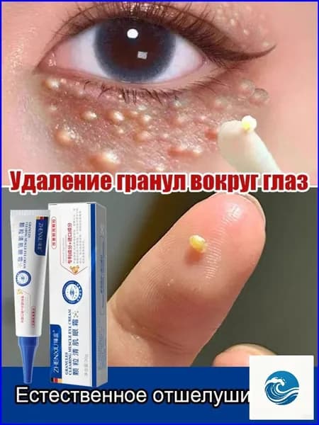Анти-жировиковый крем для век, устраняет жировики, разглаживает кожу, 30 г