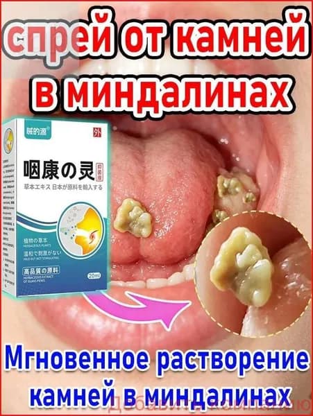 Новинка! Набор для удаления миндалин
