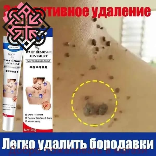 Мазь от бородавок, против генитальных бородавок, папиллом, ороговевшей кожи, мазь от прыщей, 20 гПечатная версия