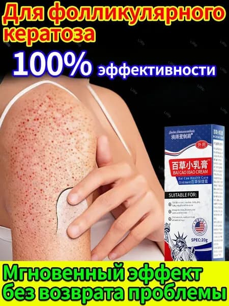 Детский крем от фолликулярного кератоза для чувствительной кожи