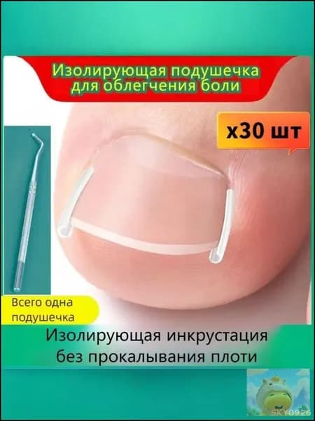 Эксклюзивный фиксатор против врастания