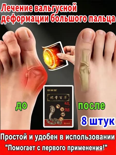 пластырь от косточки на большом пальце Облегчите боль в ногах и улучшите выпячивание суставов
