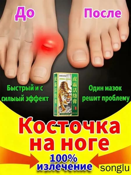 Крем при вальгусной деформации, от шишек на больших пальцах ног,пластырь обезболивающий для суставов и мышц,20 мл