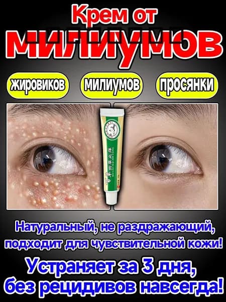 Средство от жировиков, милиумов и просянки под глазами