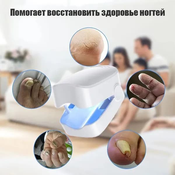 Лампа для облучения ногтей, Устройство для стерилизации, для лечения грибка, Для поврежденных обесцвеченных толстых ногтей, Терапия синим светом, Перезаряжаемый