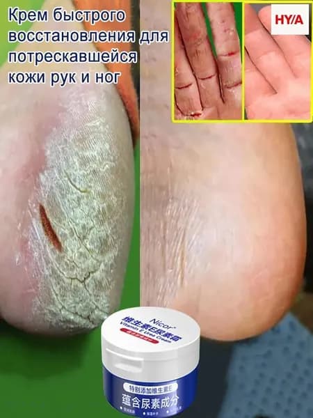 Крем Мазь от трещин для сухой кожи ног и рук, заживление, ,восстанавливающий и увлажняющий для грубой рук