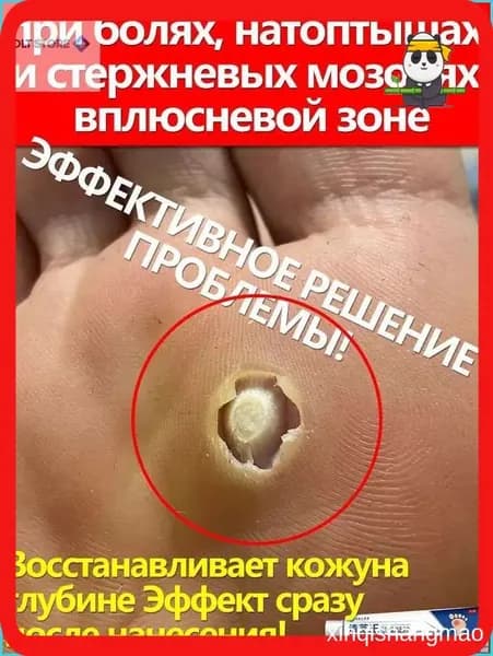 Скидка сегодняпри болях, шишках и в плюсневой зоне, от стержневых шишек 20 г