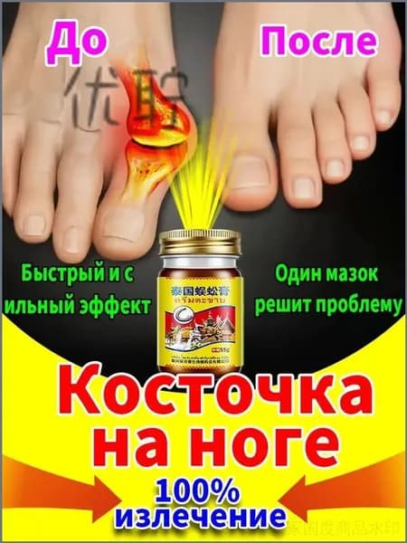 Мазь при вальгусной деформации косточки обезболивающая 55 г
