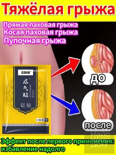 Пластырь от симптомов паховой грыжи: боль и тяжесть внизу живота