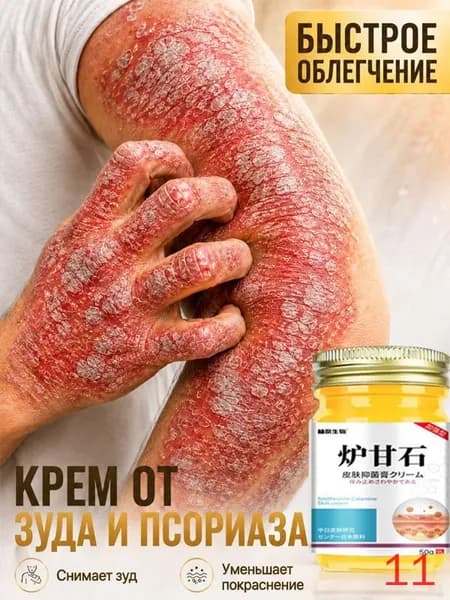 Негормональная мазь от псориаза, экземы, нейродермита и грибковых заболеваний, китайский крем от псориаза, 50 г.(Подходит для вечера)