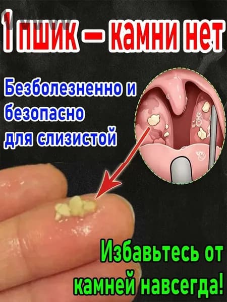 Прибор и спрей для очистки миндалин от пробок