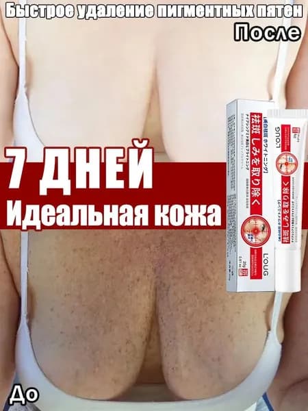 Отбеливающий крем для лица, от пигментации и веснушек, для удаления мелазмы, веснушек, возрастных и других видов пятен 20 г