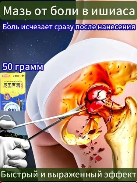 Мазь от седалищный нерв Ишиас