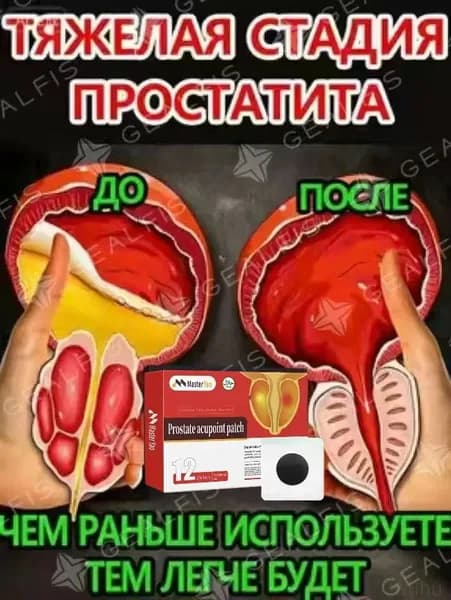 Япония урологический пластырь, пластырь от простатита,дизурии,нефрите,частых и болезненных мочеиспусканиях,эректильной дисфункции,инфекциях мочеполовой системы, 10 шт