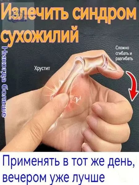 Крем от тендовагинита,болях в суставах руки,при артрите,ревматоидном,отеки и воспаления,в области запястья и фалангов пальцев,15 г,Китайская Чудо
