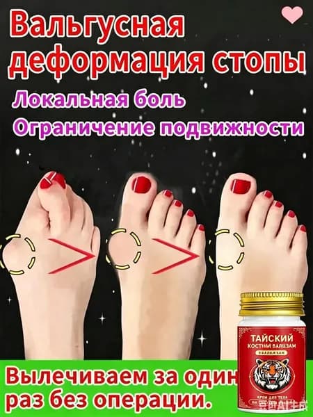 Легендарный тайский крем от косточки на ноге