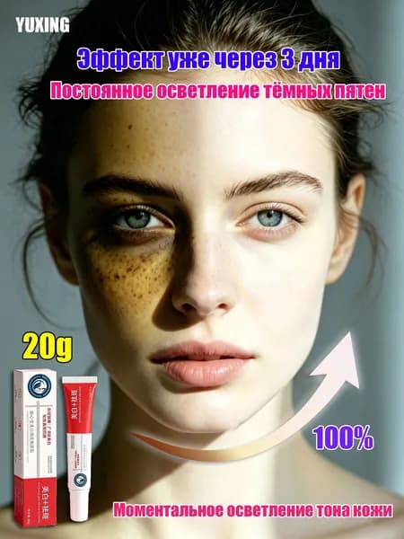 YUXING Крем для осветления веснушек, пигмента и темных кругов под глазами 20г 1 шт