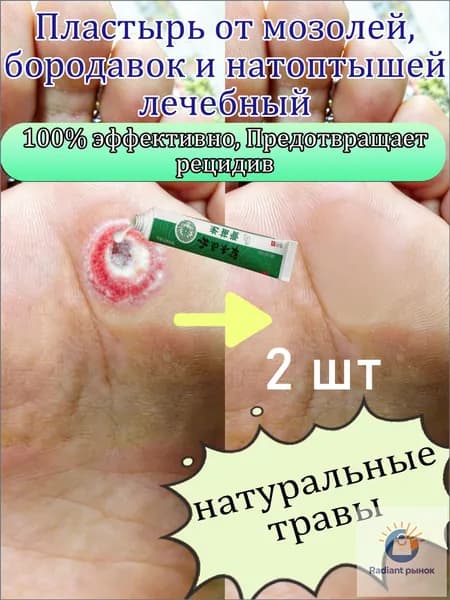 Пластырь от мозолей, бородавок и натоптышей лечебный, быстрое смягчение, безболезненное удаление,20 г 2 шт.