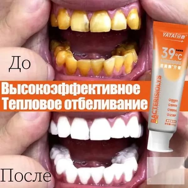 Зубная паста отбеливающая, профессиональная 120 г, Содержит антибактериальный лизоцим, для чувствительных зу