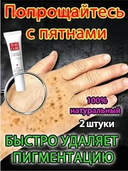 Отбеливающий крем от веснушек и солнечных пятен, подходит для удаления и исчезновения желтых пятен и старчес