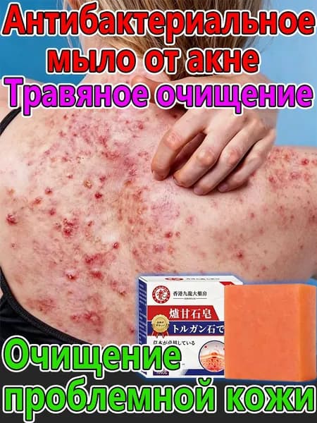 Твердое мыло