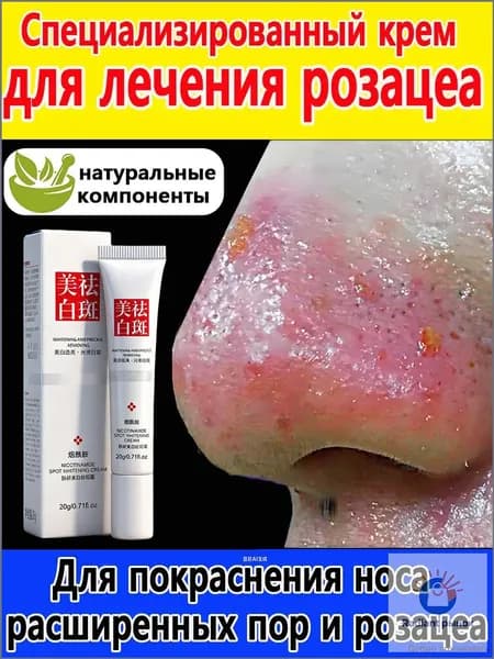 Мазь от розацеа на лице купероза и покраснений, покраснений "Тонус-Капилляр Лица".для проблемной кожи,100% натуральный В безгормональном составе, 20 мл.