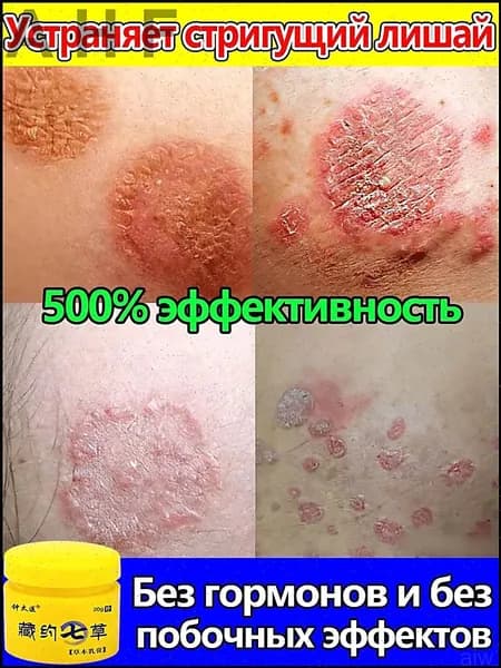 Мазь от лишая для человека