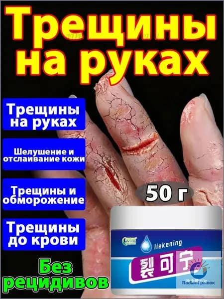 Китайская мазь от трещин на руках: натуральный состав и быстрое действие.